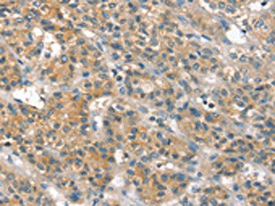PPP2CA Antibody