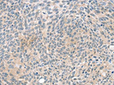 PPP2CA Antibody
