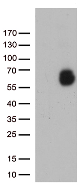 PPP2R1B antibody