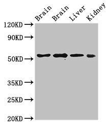 PPP2R2A Antibody