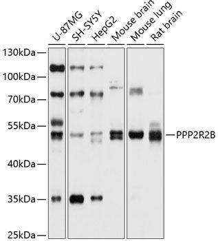 PPP2R2B antibody
