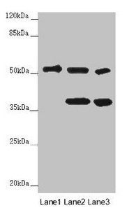 PPP2R2D Antibody