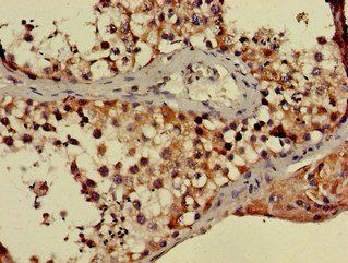 PPP2R3A Antibody