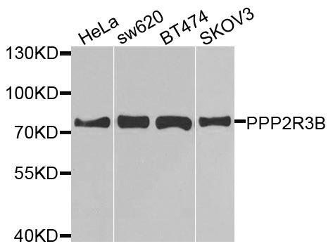 PPP2R3B antibody