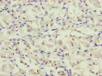PPP2R3C Antibody