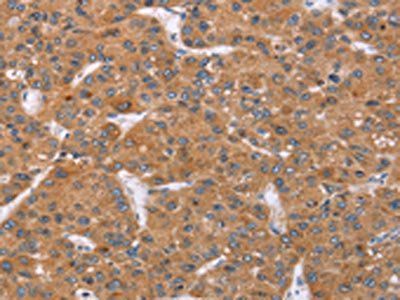 PPP2R3C Antibody