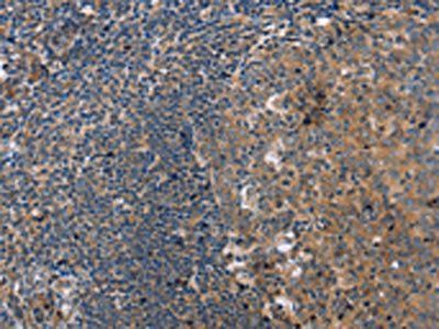 PPP2R3C Antibody