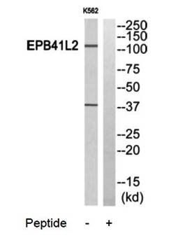 PPP2R5A antibody