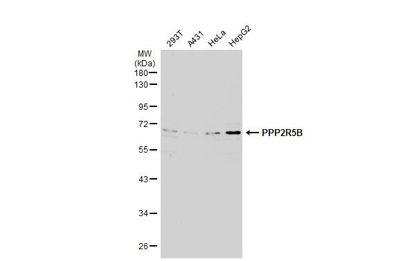 PPP2R5B antibody [C3], C-term