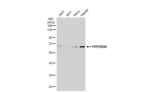 PPP2R5B antibody