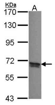 PPP2R5B antibody