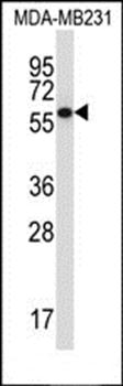 PPP2R5C antibody