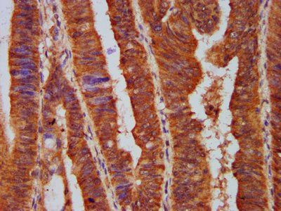 PPP2R5E Antibody