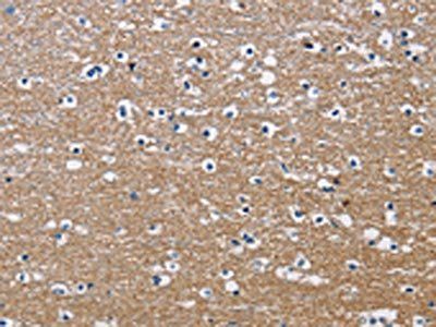 PPP3CA Antibody