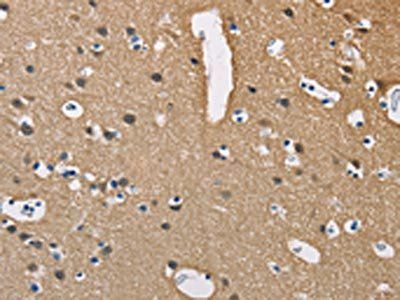 PPP3CA Antibody