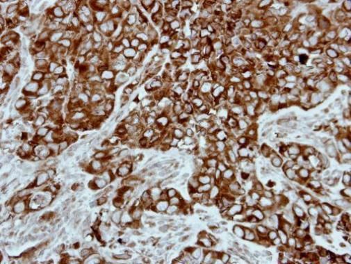 PPP3CB antibody [N1N3]