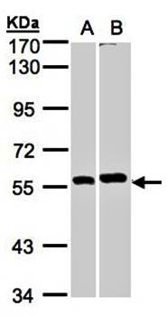 PPP3CB antibody