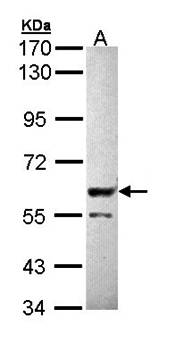 PPP3CB antibody