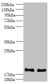 PPP3R1 Antibody