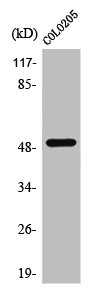 PPP4R1L antibody