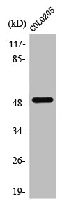 PPP4R1L Antibody