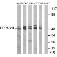 PPP4R1L antibody