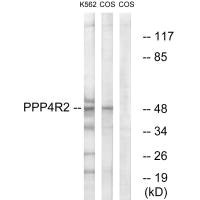 PPP4R2 Antibody
