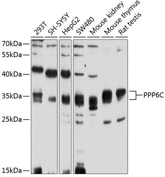 PPP6C antibody