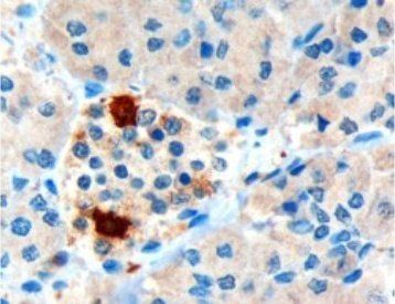 Goat anti-Pancreatic Polypeptide / PPY Antibody