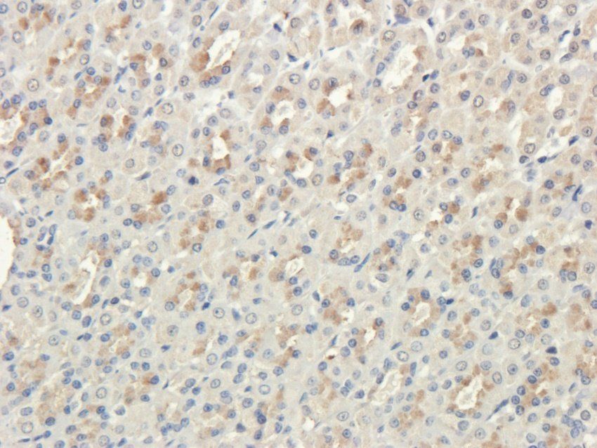 PQBP1 antibody