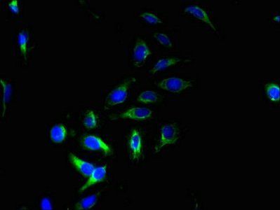 PQLC2 Antibody