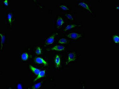 PQLC2 antibody