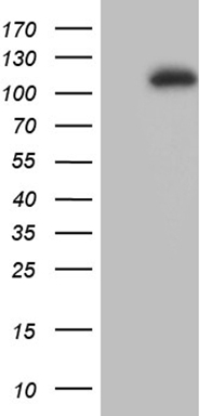 PR3 (PRTN3) antibody