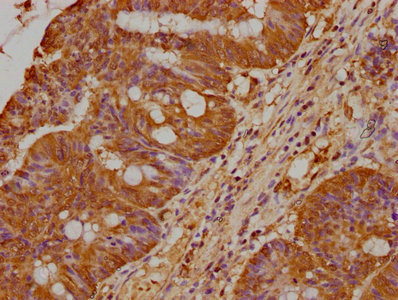 PRAMEF18 Antibody