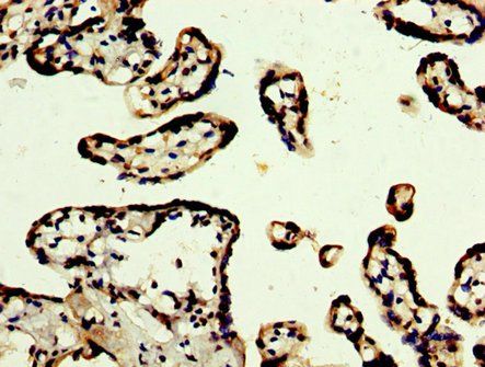 PRDM10 Antibody