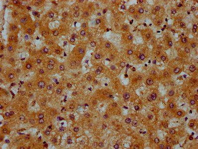 PRDM11 Antibody