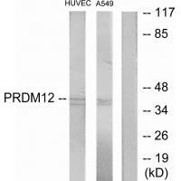 PRDM12 antibody