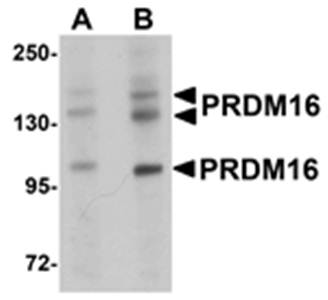 PRDM16 Antibody