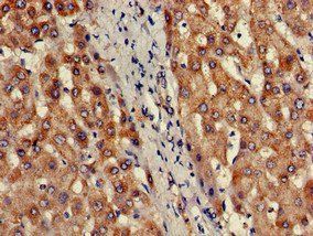 PRDM2 Antibody