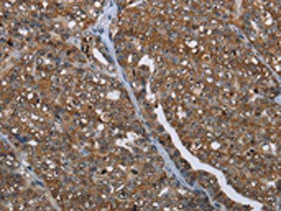 PRDM2 Antibody