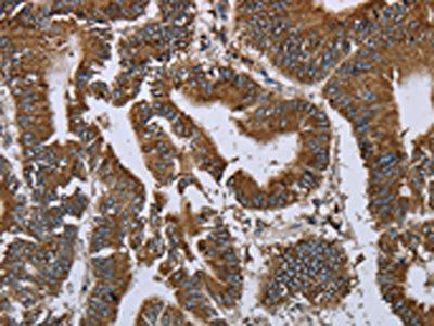PRDM2 Antibody
