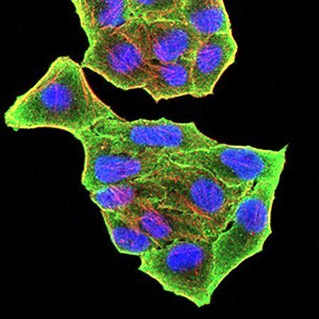 PRDM5 Antibody