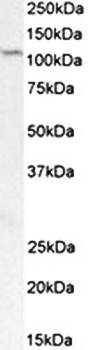 Goat anti-Prdm9 (rat aa440-451) Antibody