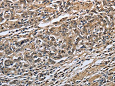 PRDX6 Antibody