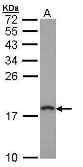 Prefoldin 5 antibody