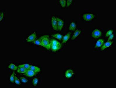 PFDN1 Antibody