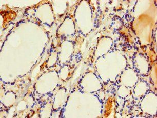 PRELID3B Antibody