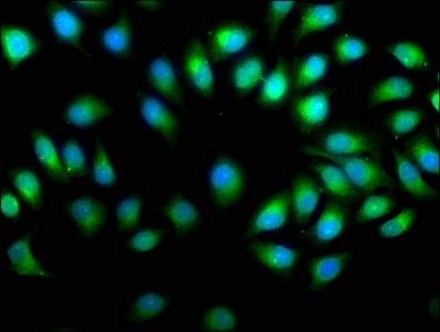 PREP Antibody