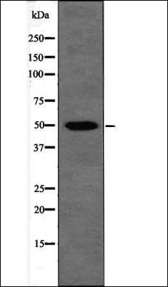 Presenilin 2 (Phospho-Ser330) antibody