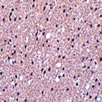 Presenilin1 Antibody